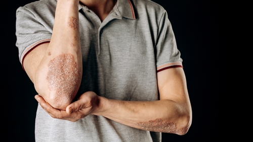 Paid Clinical Research Studies | Trial Partners